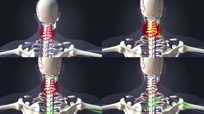 三维颈椎疼骨骼人体