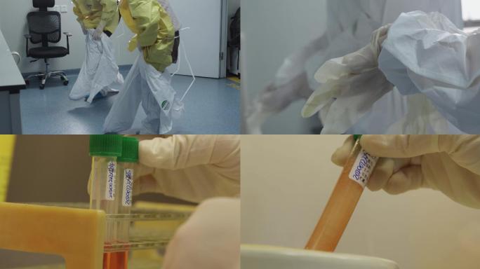 新型冠状病毒检测核酸PCR