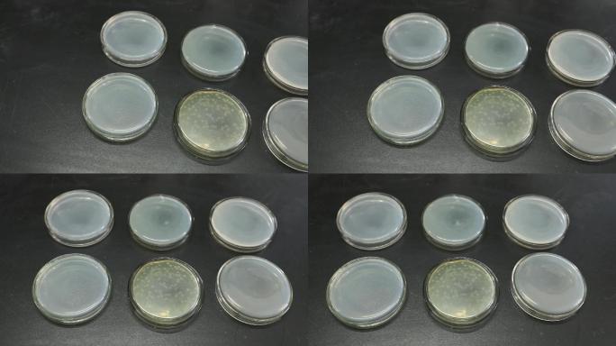 实验室微生物培养皿对比（2K）