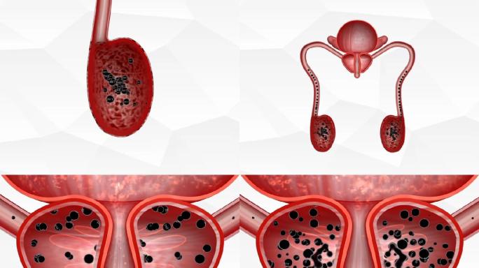 人体生殖系统排尿不畅