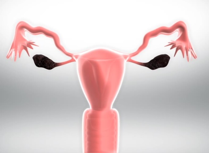 子宫卵巢功能紊乱