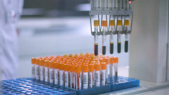 医院检验科验血