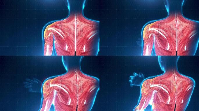 人体结构肩膀疼痛动画可定制