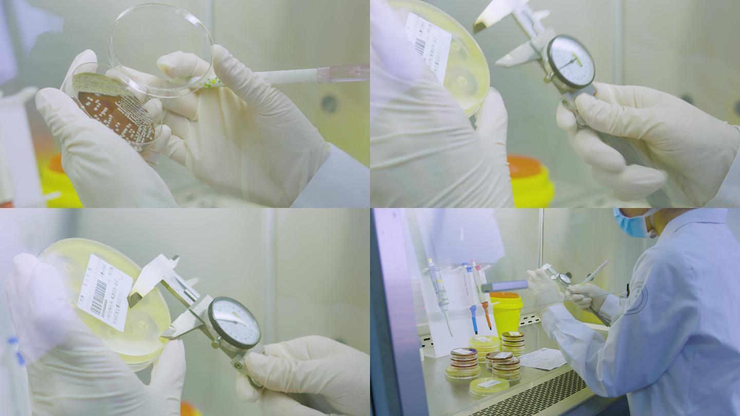 微生物病菌细菌培养检测分析【原创】