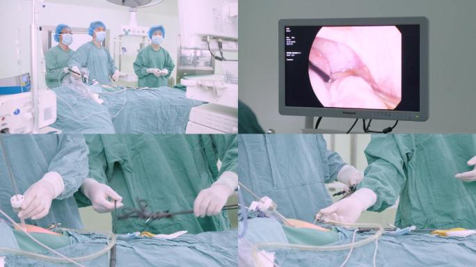 内窥镜手术腹腔镜手术微创手术