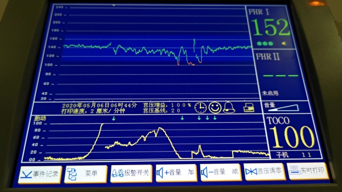 4K孕妇新生儿胎心监护