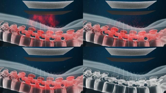 三维腰椎治疗效果