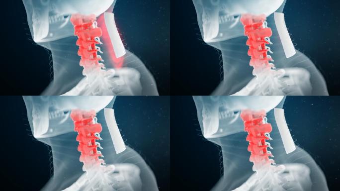 科技感三维颈椎
