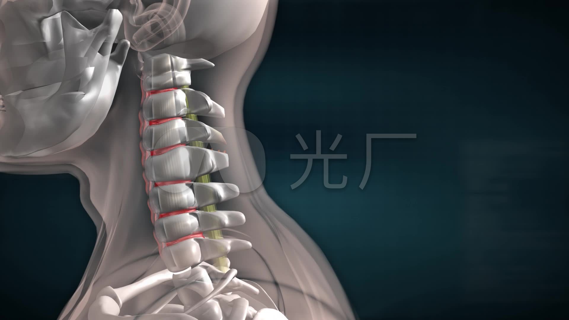 颈椎间盘突出症 脊髓型颈椎病 颈椎管狭窄症 - 好大夫在线