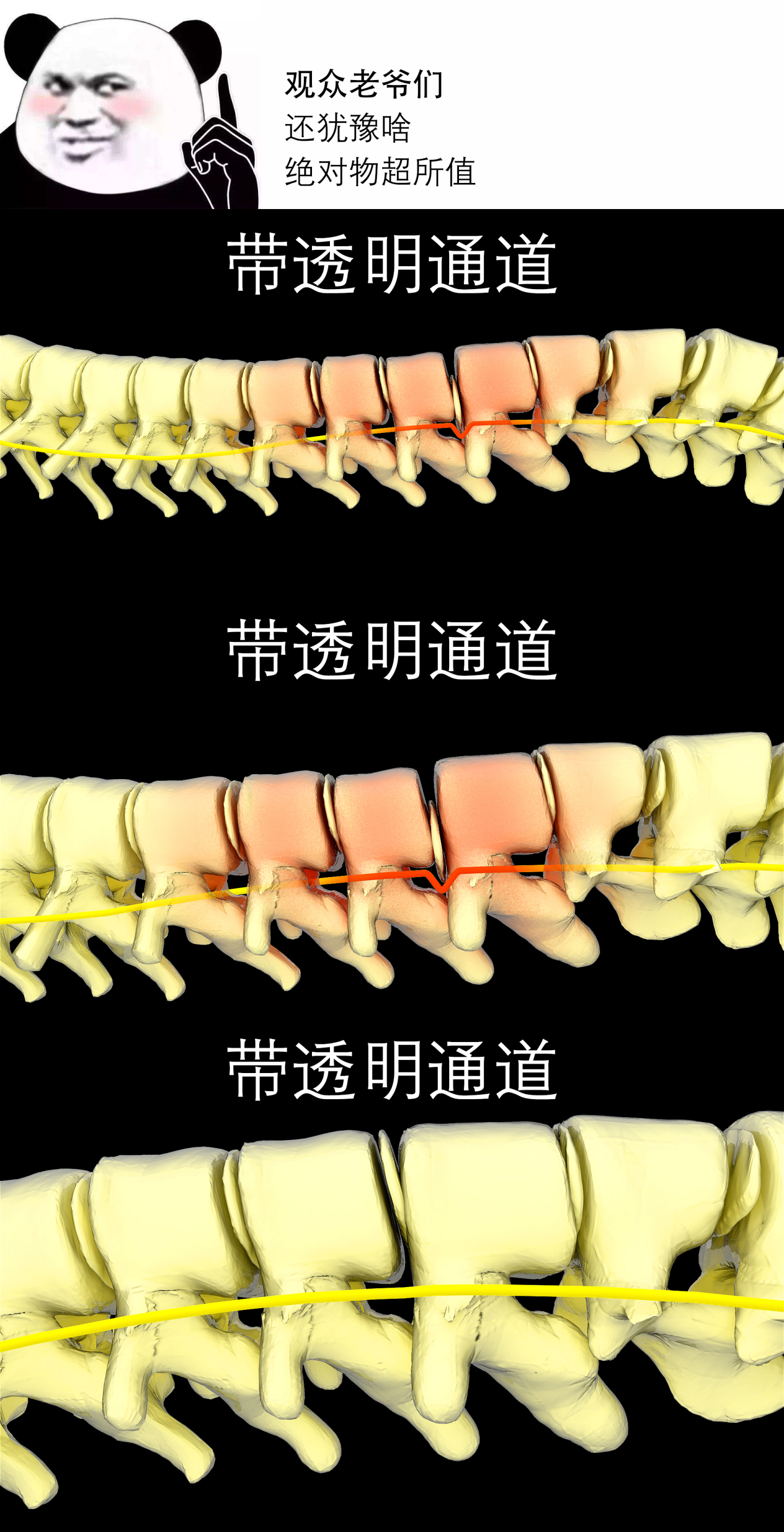 跨越整个背部的竖脊肌最易受伤，8个动作远离损伤_脊柱