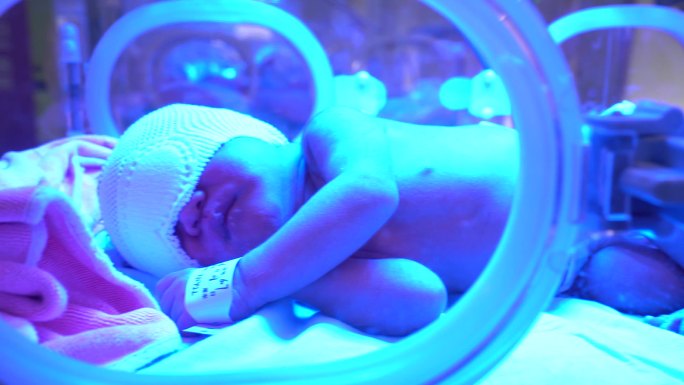 医院新生儿监护室早产宝宝