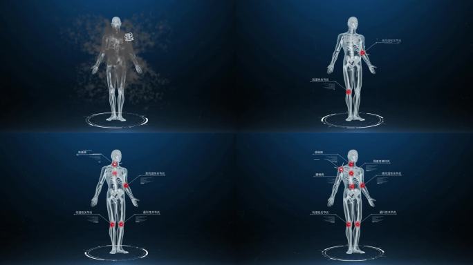 【4K无插件】风寒湿邪引发骨病