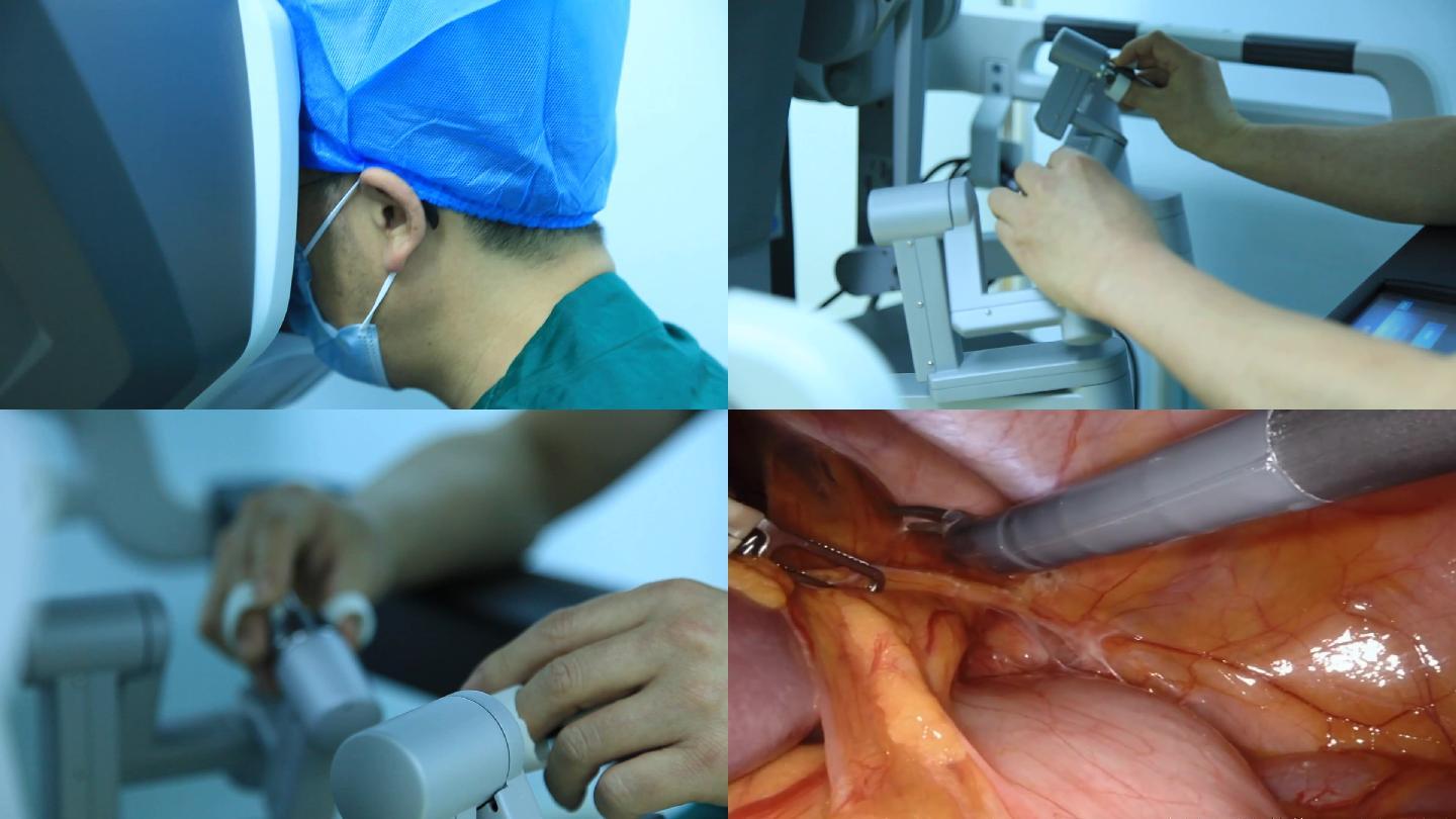 达芬奇手术机器人手术操作