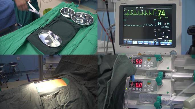 手术室设备仪器无影灯注射器呼吸机准备工作