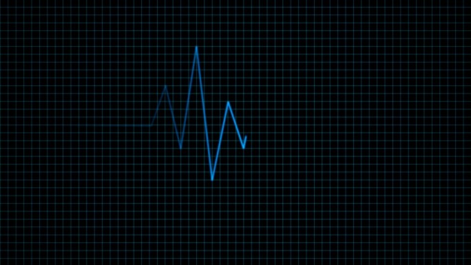 原创AE心电图心脏监护带音效AE模板