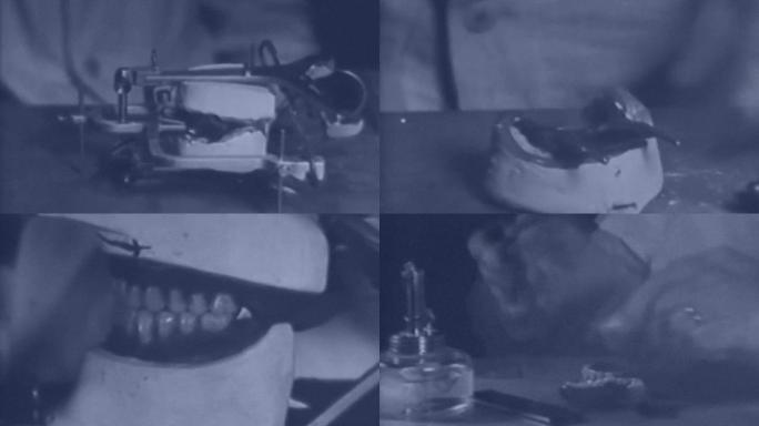 30年代口腔医院牙科医生制作石膏模具假牙