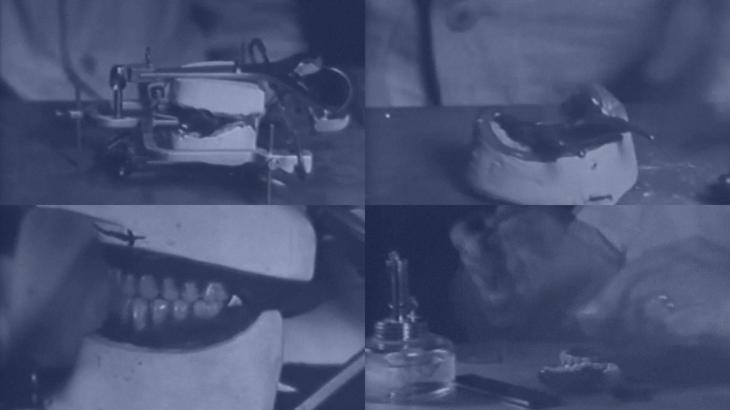 30年代口腔医院牙科医生制作石膏模具假牙