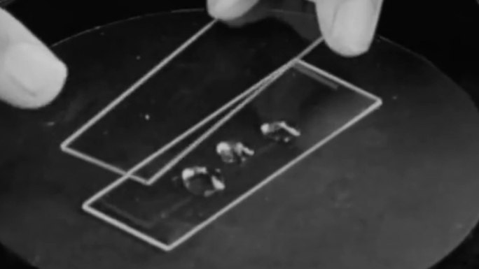 40年代医疗专家显微镜试管病菌传染病筛选