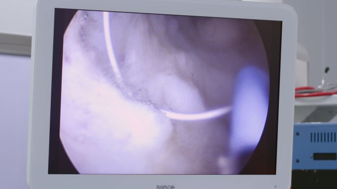 4K医院医生手术室做手术视频素材