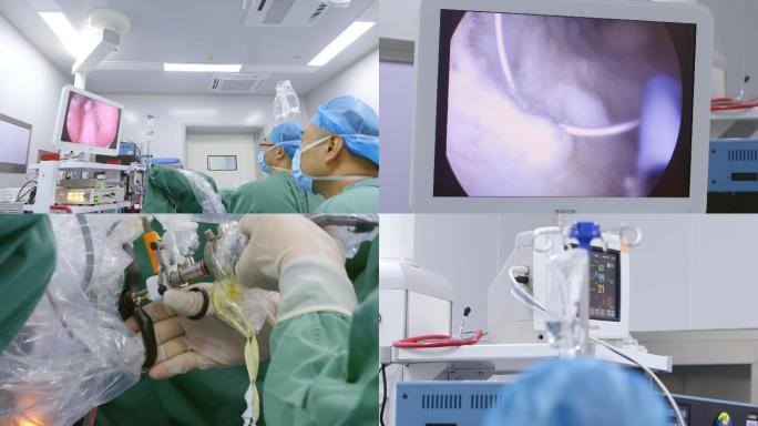 4K医院医生手术室做手术视频素材