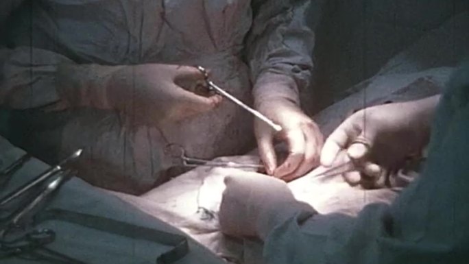70-80年代手术室