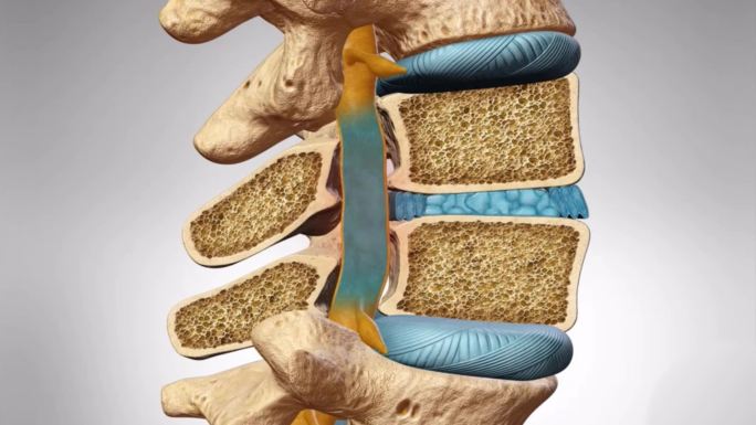 骨性压迫颈椎间盘突出腰椎间盘突出神经压迫