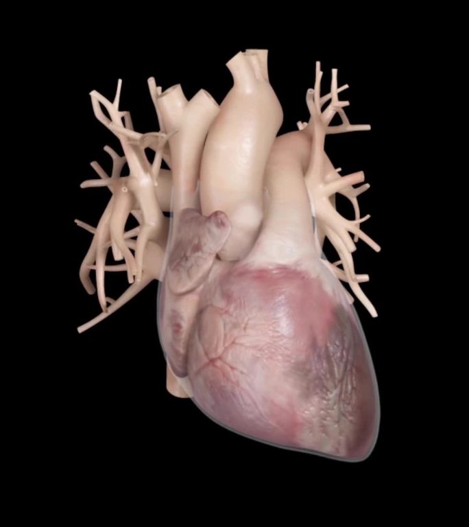 心脏病心脏疾病心包积液演示动画