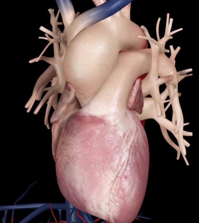 心脏疾病心脏血管壁增厚增大动画演示