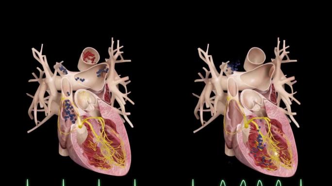 心脏工作原理血液循环心电图动画演示2