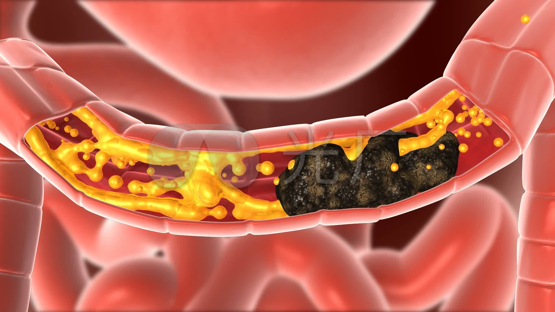 肠道菌群与上皮细胞的屏障作用_微生物_病原_黏液