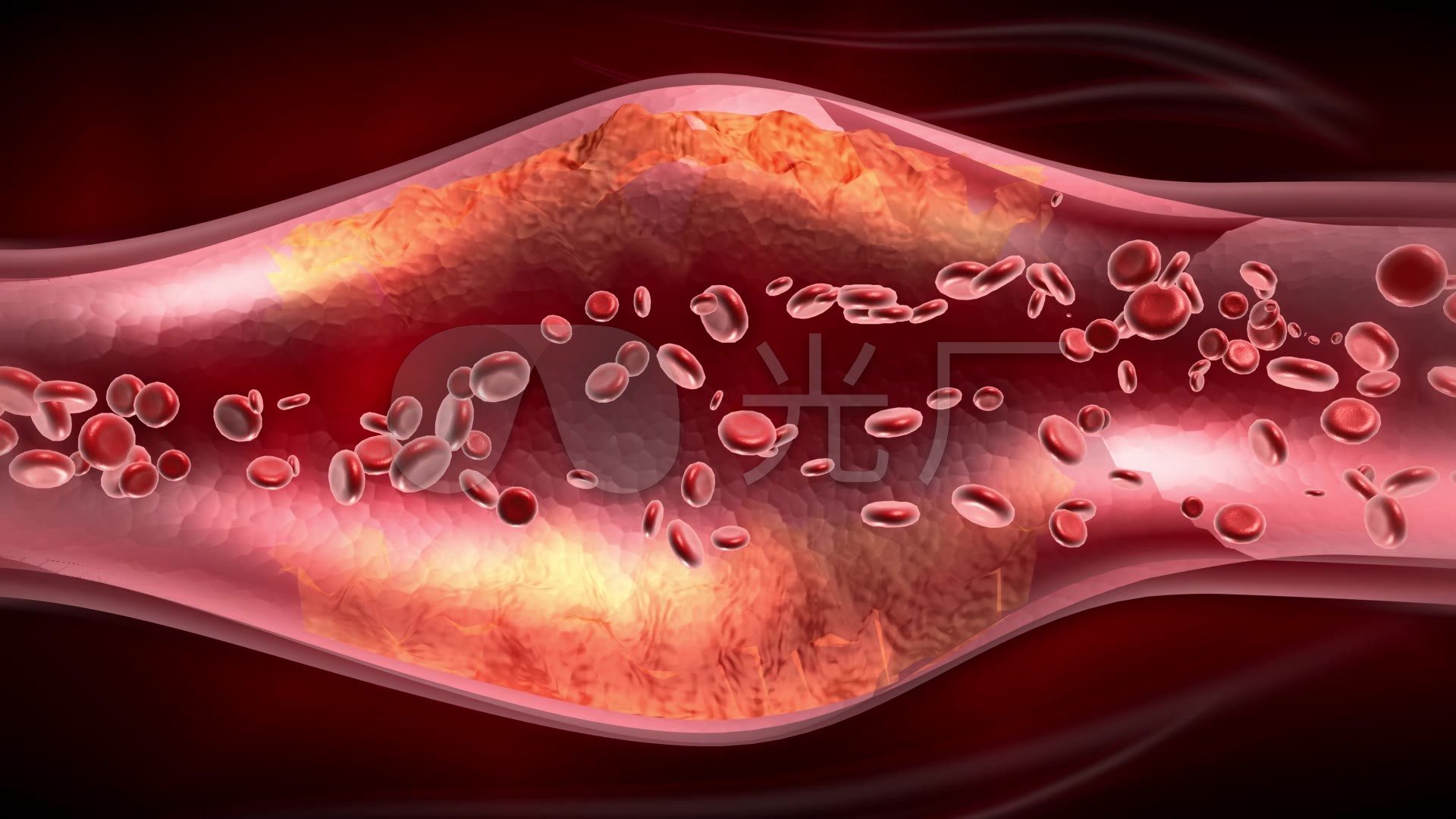 面红/微丝血管扩张 - iSKIN
