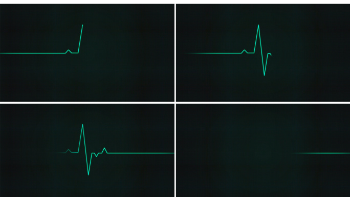 心电图-心率监测仪器-心脏跳动波