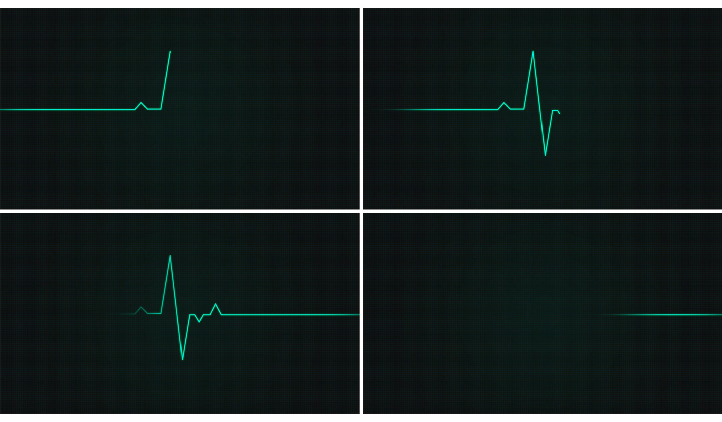 心电图-心率监测仪器-心脏跳动波