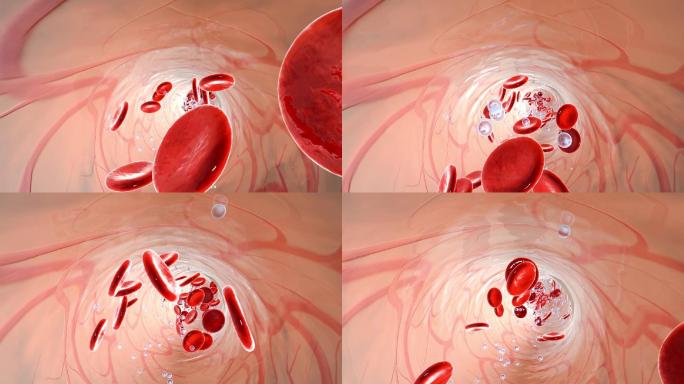 血细胞运动输血特写镜头