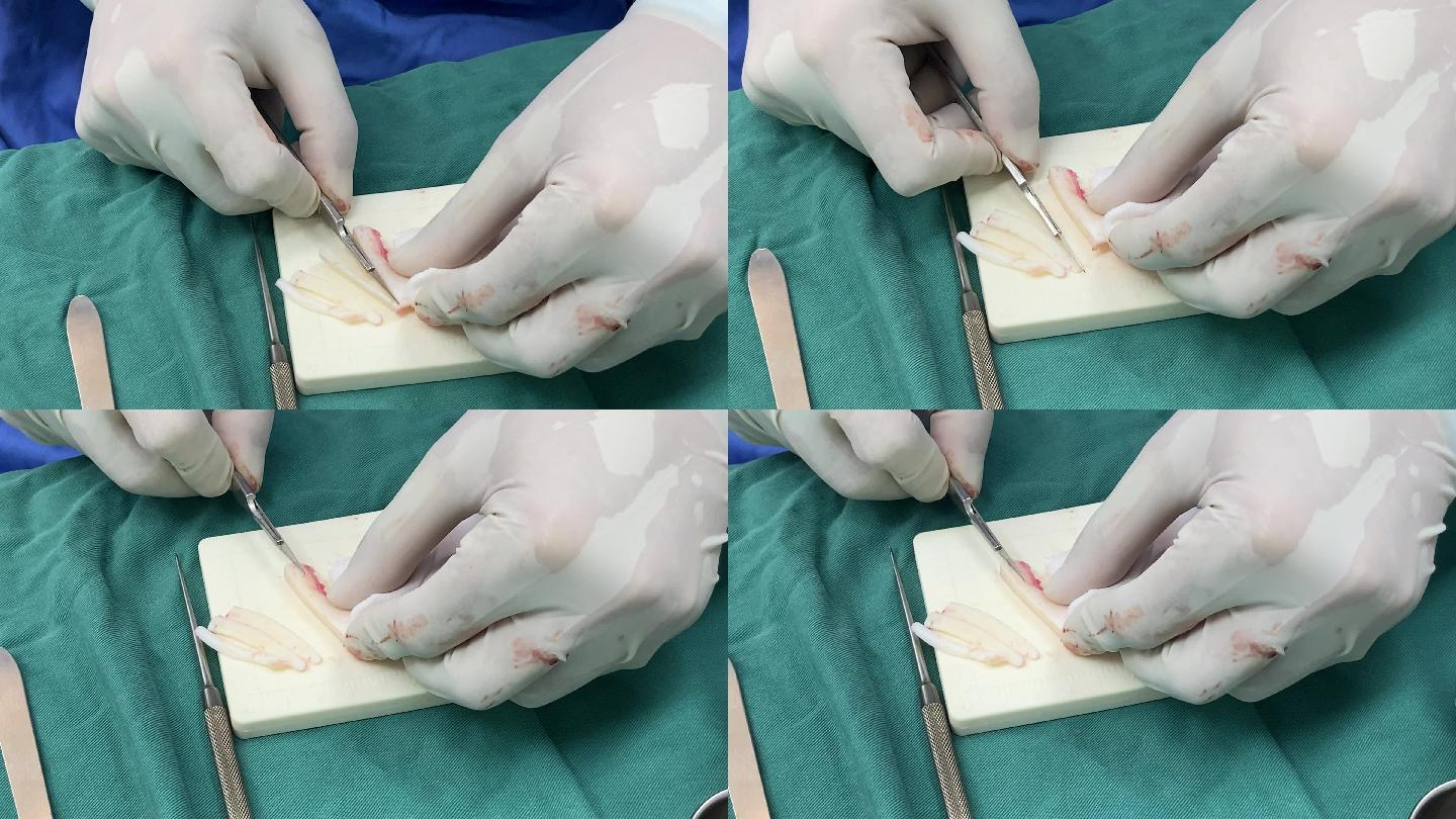 4K手术室实拍素材手术刀鼻假体雕刻