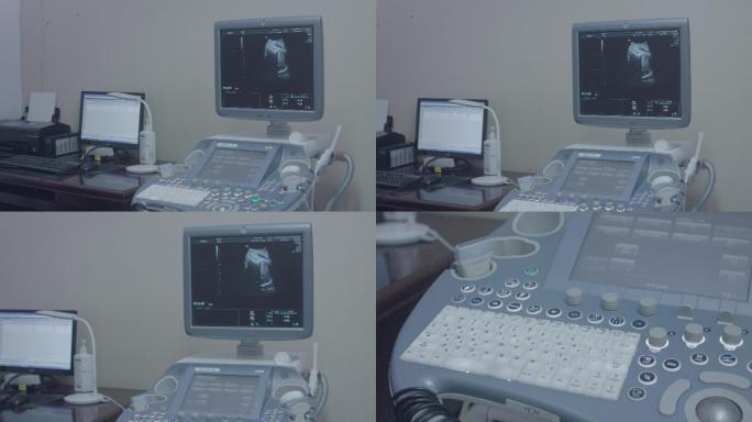 医院孕妇三维b超机设备拍摄4k