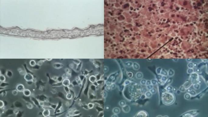 80年代癌症研究、肿瘤研究