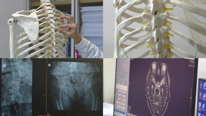 人体骨骼模型脊柱脑部扫描图