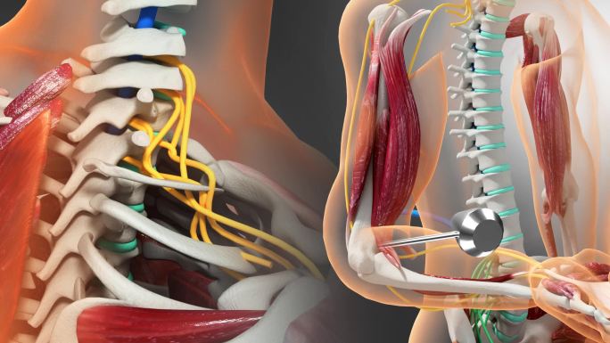 脊髓颈神经肱二头肌反射原理三维动画