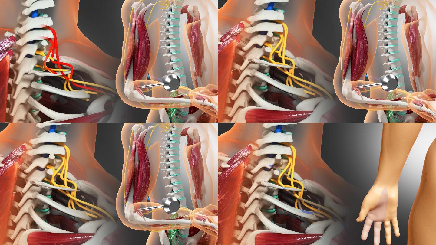脊髓颈神经肱二头肌反射原理三维动画