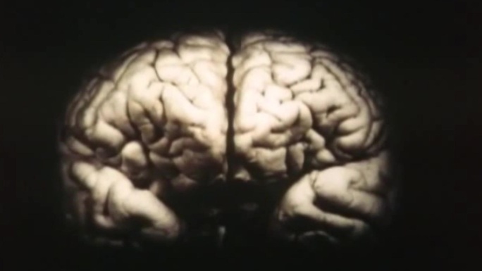 上世纪脑溃疡研究、脑垂体