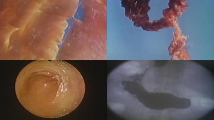 上世纪人体消化吸收、人体消化液