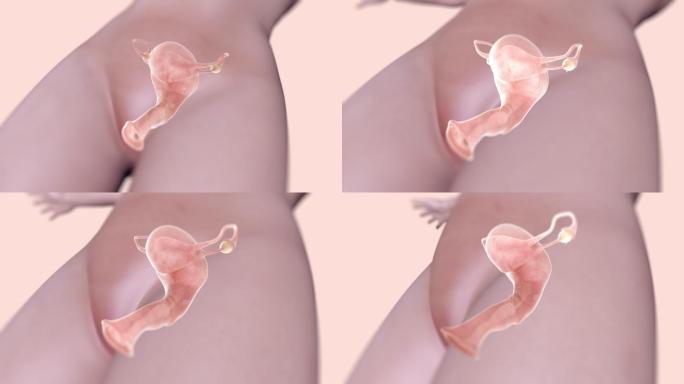 女性子宫阴道卵巢护理保养视频素材