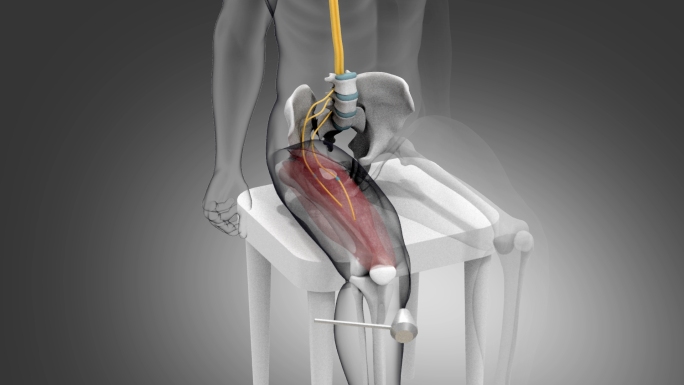 正常或异常膝跳反射原理三维动画演示素材