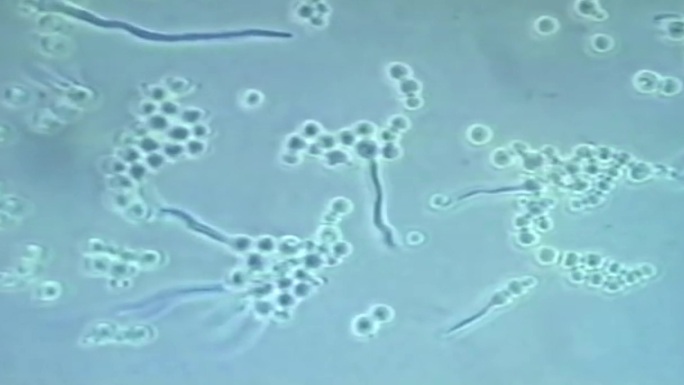 上世纪霉菌研究、霉菌孢子、霉变