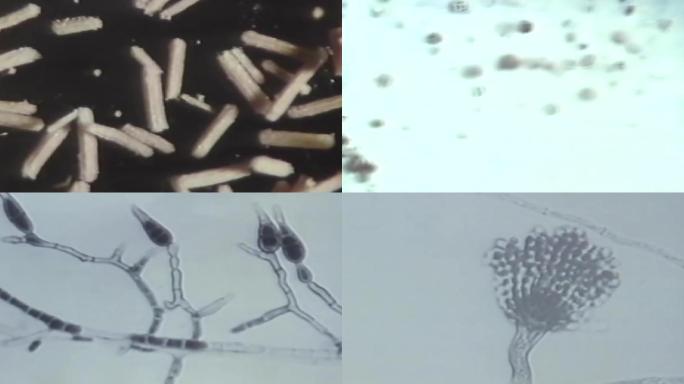 上世纪霉菌研究、霉菌孢子霉变发霉