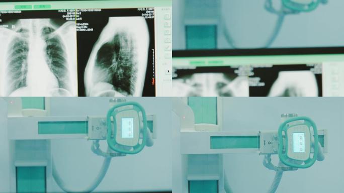 肺部检查设备钼靶设备乳腺检查设备
