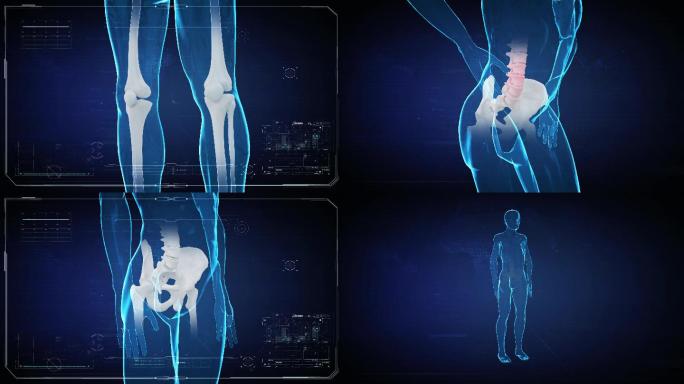腰腿疼痛关节炎补钙