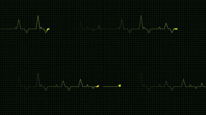 心电图波动特效