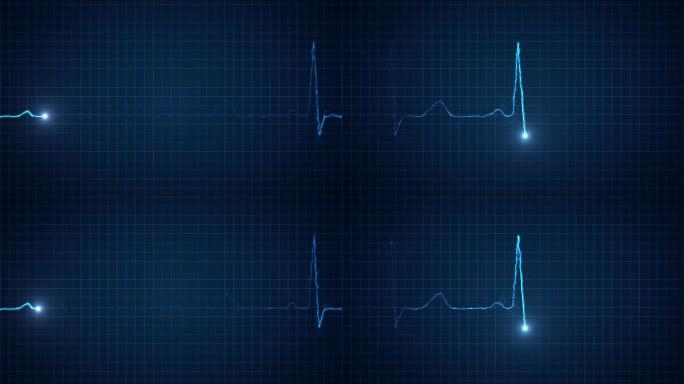 心电图跳动视频素材4K